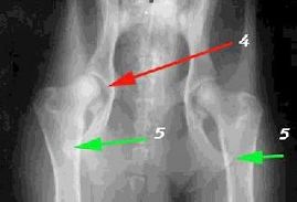 X-ray images