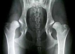 X-ray images